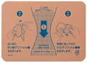 フェルビナクテープ70mg「三笠」